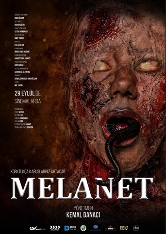 HO00006047_638309999061893262_melanet.png